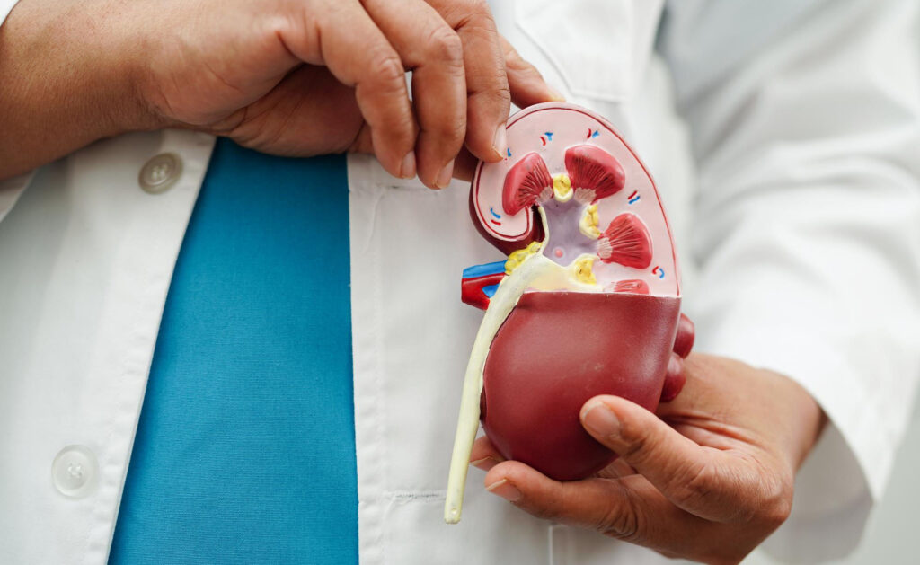 racc-kidney-failure1