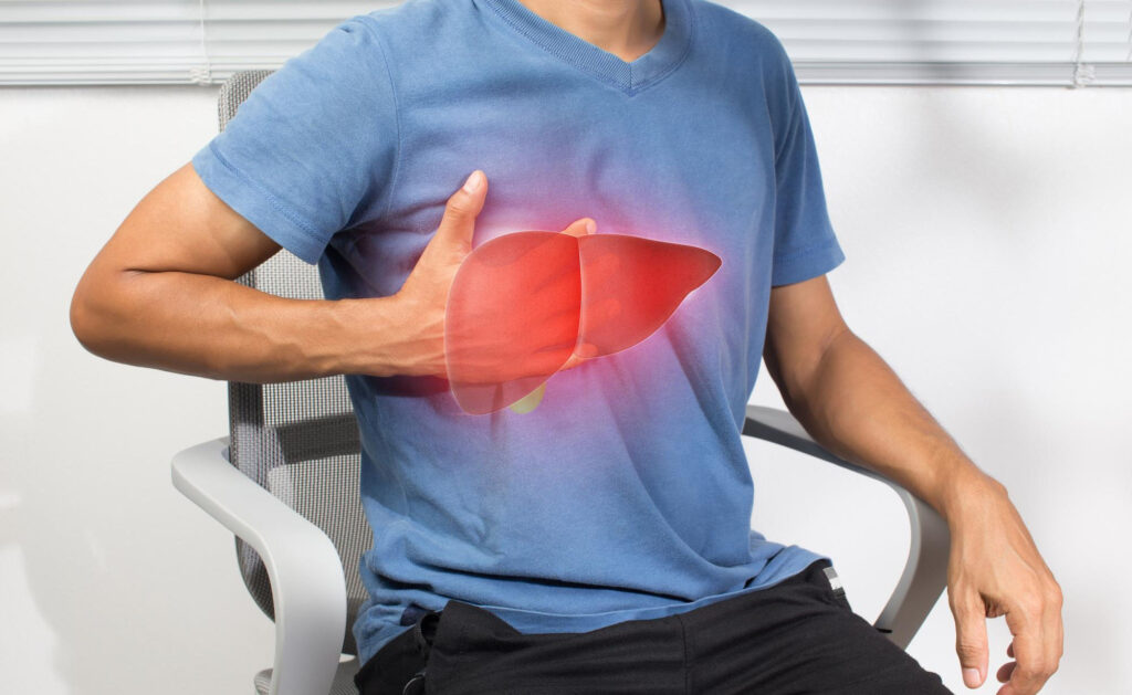 racc-liver-failure-1